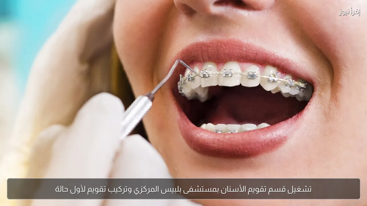 تشغيل قسم تقويم الأسنان بمستشفى بلبيس المركزي وتركيب تقويم لأول حالة
