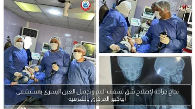 نجاح جراحة لإصلاح شق بسقف الفم وتجميل العين اليسرى بمستشفى أبوكبير المركزي بالشرقية