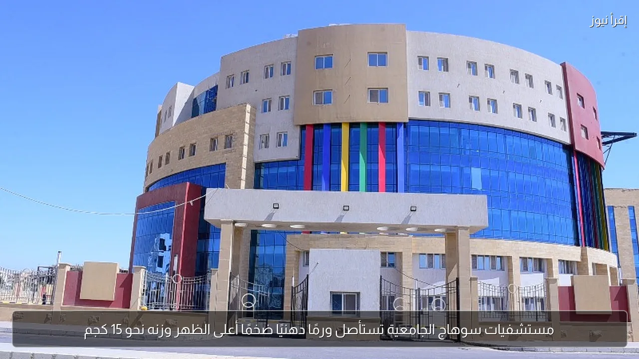 مستشفيات سوهاج الجامعية تستأصل ورمًا دهنيًا ضخمًا أعلى الظهر وزنه نحو 15 كجم