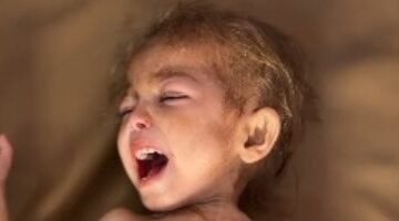 حياة الطفلة أرجوان الدهيني تتوقف على الإخلاء من غزة بعد