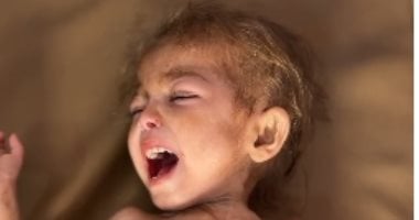 حياة الطفلة أرجوان الدهيني تتوقف على الإخلاء من غزة بعد تدهور حالتها الصحية