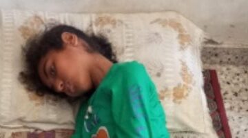طفلة تصارع مرضًا نادرًا تفقد الوعي 20 يومًا وتنتظر علاجًا
